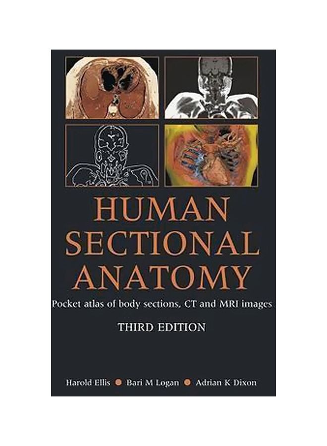 Human Sectional Anatomy Paperback English by Adrian K. Dixon - 30-Nov-09 