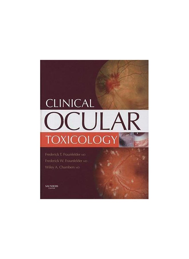 Clinical Ocular Toxicology Hardcover English by Wiley A. Chambers - 08 September 2011