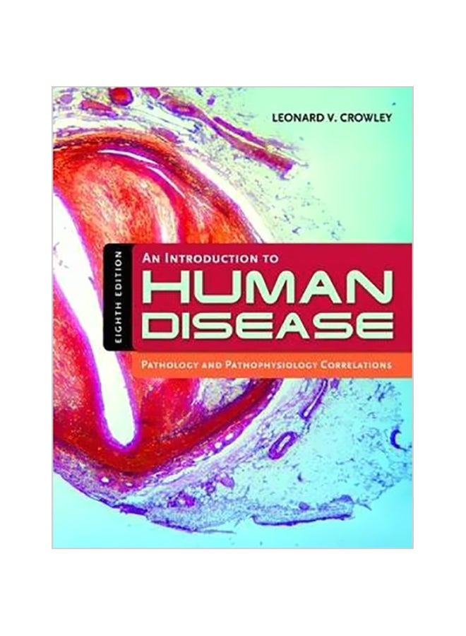 An Introduction To Human Disease: Pathology And Pathophysiology Correlations Hardback English by Leonard V. Crowley - 01 January 2010 