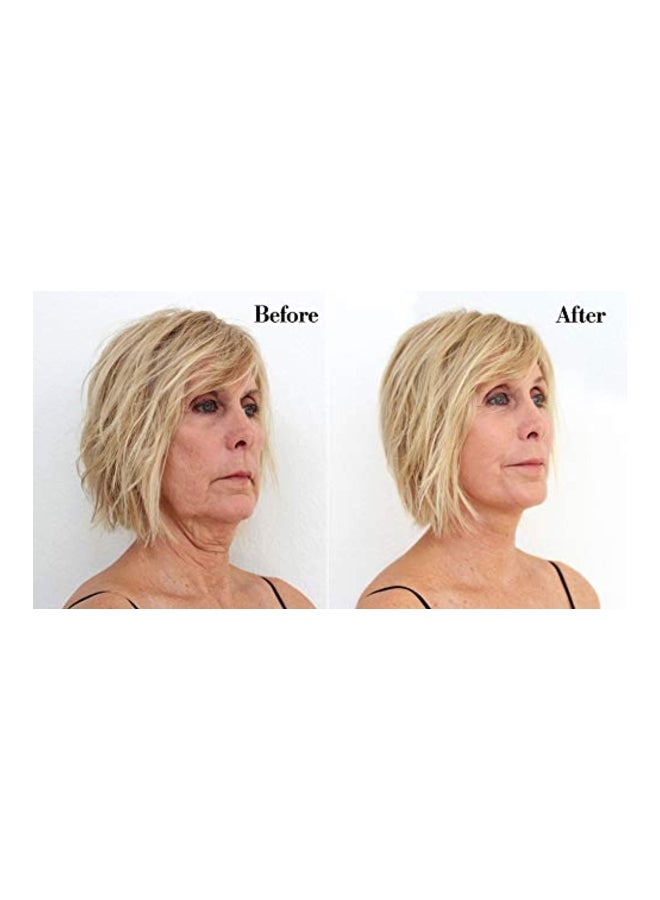 برينج إت أب مجموعة أشرطة لشد الوجه الفوري من 32 قطعة أبيض/ أسود - Image 4