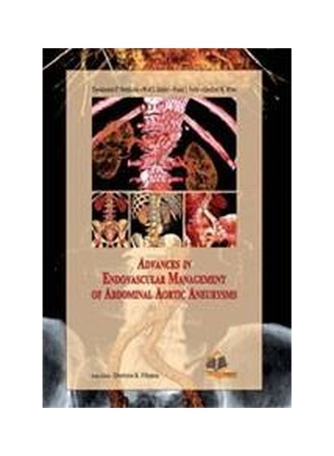 Advance In Endovascular Management Of Abdominal Aortic Aneurysms Hardback English by Theodossios Perdikides - 39902