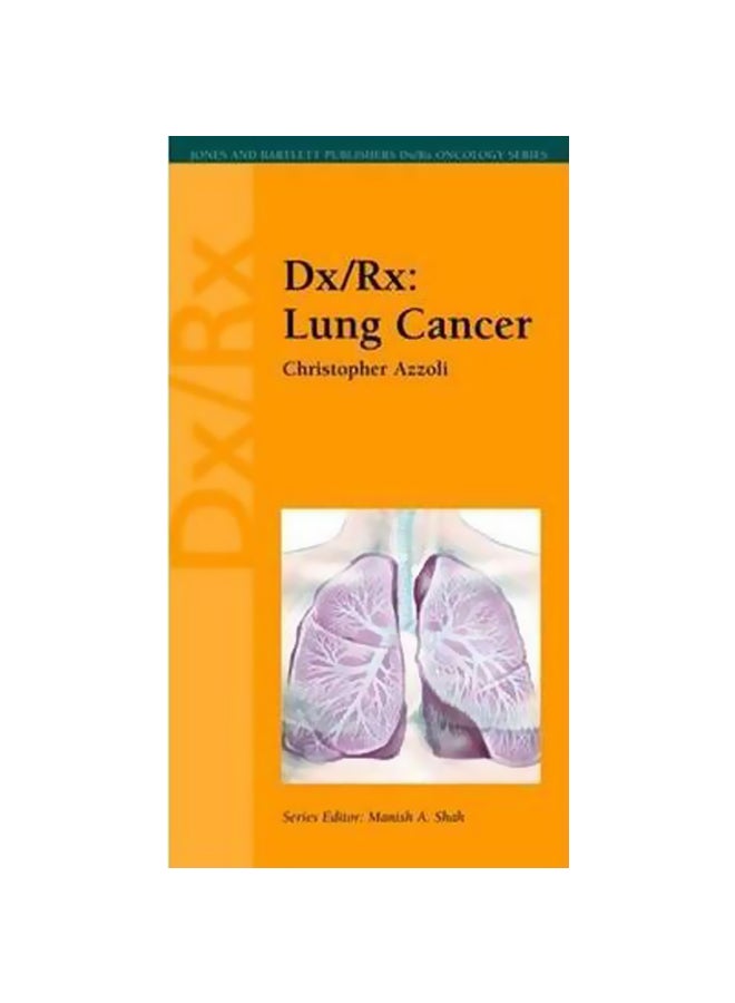 null - DXRX Lung Cancer paperback english - 38688 - Image 1