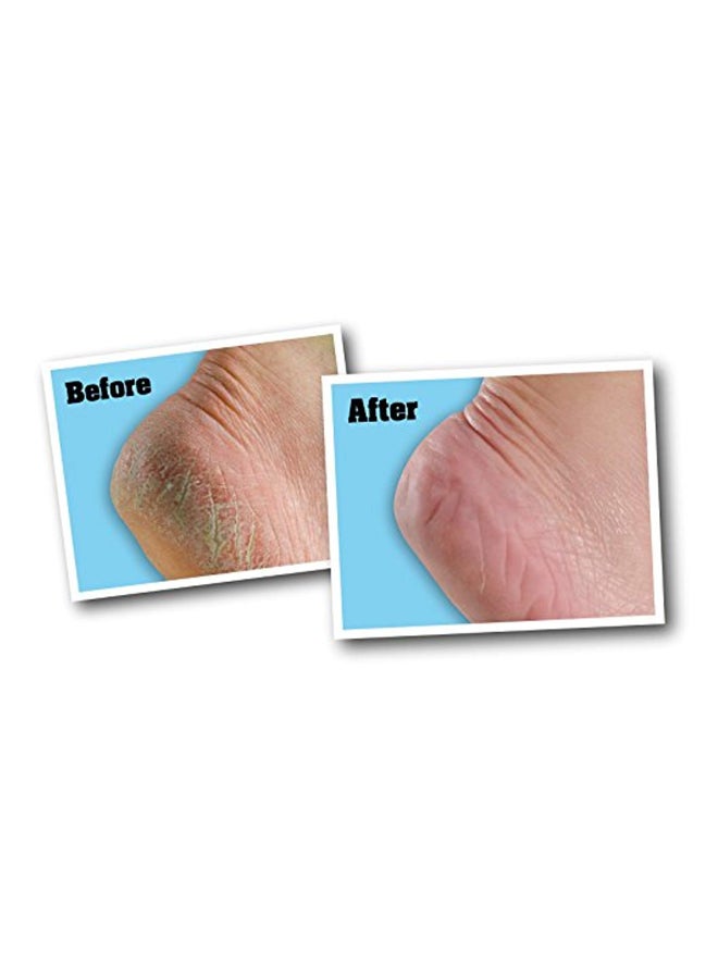 O'Keeffe's - Healthy Feet Foot Cream Blue 85grams - Image 1