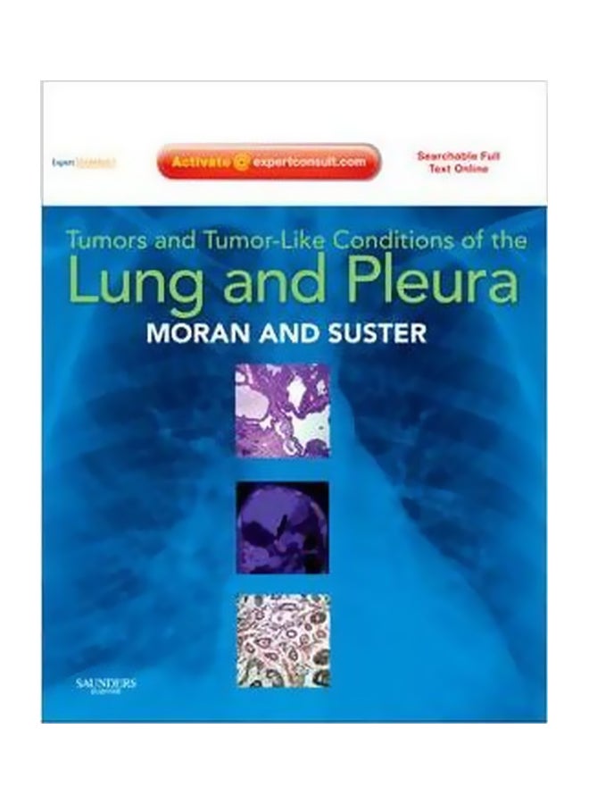 Tumors And Tumor-like Conditions Of The Lung And Pleura Hardcover English by Cesar A. Moran 