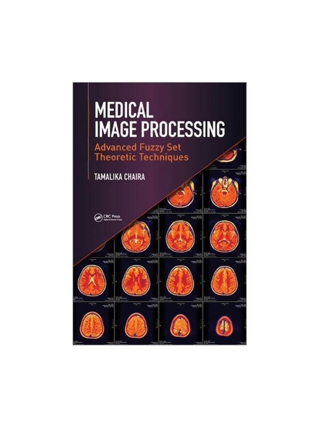 Medical Image Processing Hardcover English by Tamalika Chaira