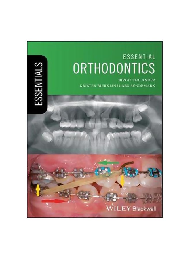 تقويم الأسنان الأساسي