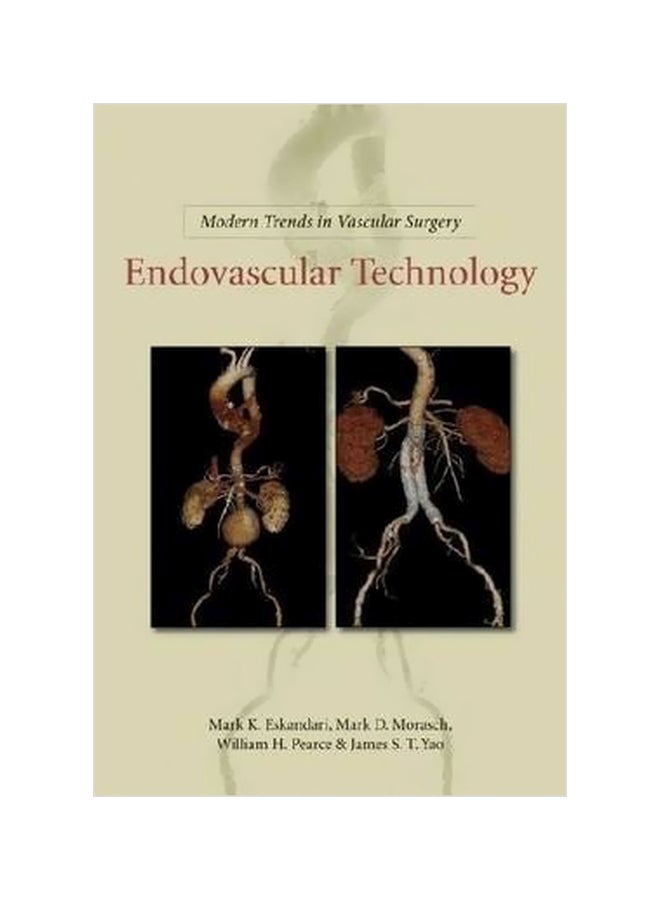 Modern Trends In Vascular Surgery:Endovascular Technology Hardcover English by William H. Pearce - 2011-03-16 