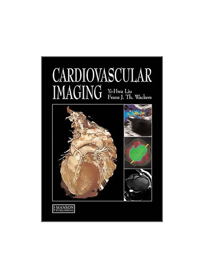 Cardiovascular Imaging Paperback English by Yi-Hwa Liu - 40083 