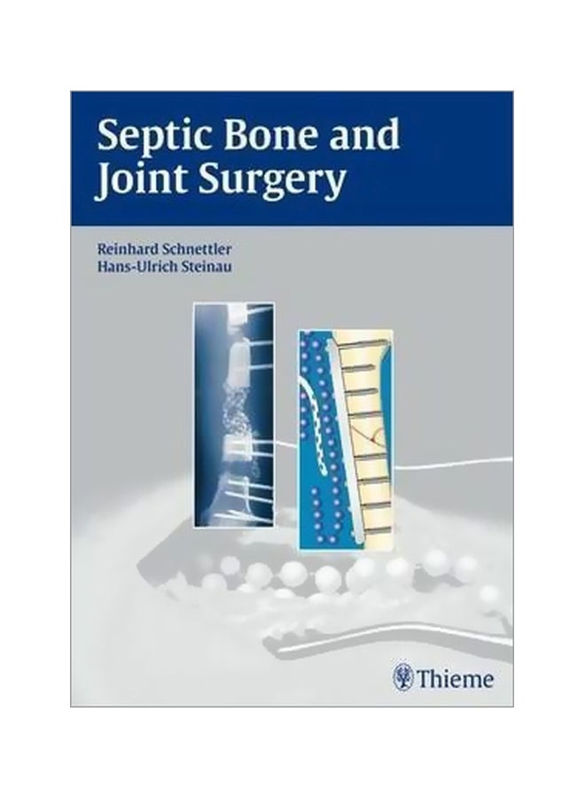 Septic Bone And Joint Surgery Hardcover English by Reinhard Schnettler - 01 Mar 2010 