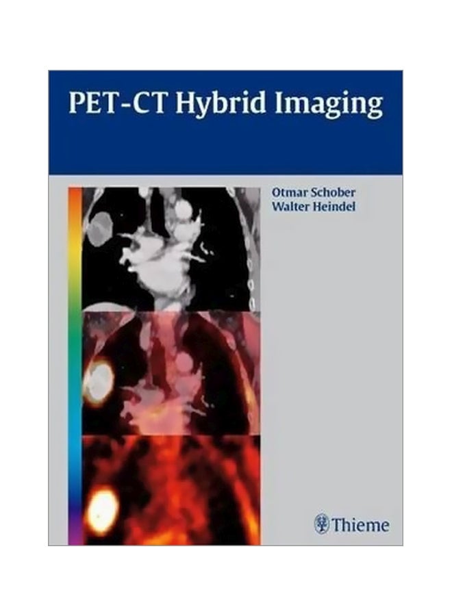 PET-CT Hybrid Imaging Hardcover English by Otmar Schober - 09 Jun 2010 