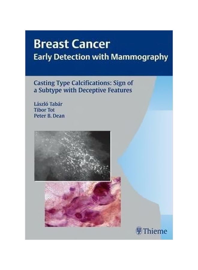 Breast Cancer: Early Detection With Mammography Hardcover English by Laszlo Tabar - 30-Mar-07 
