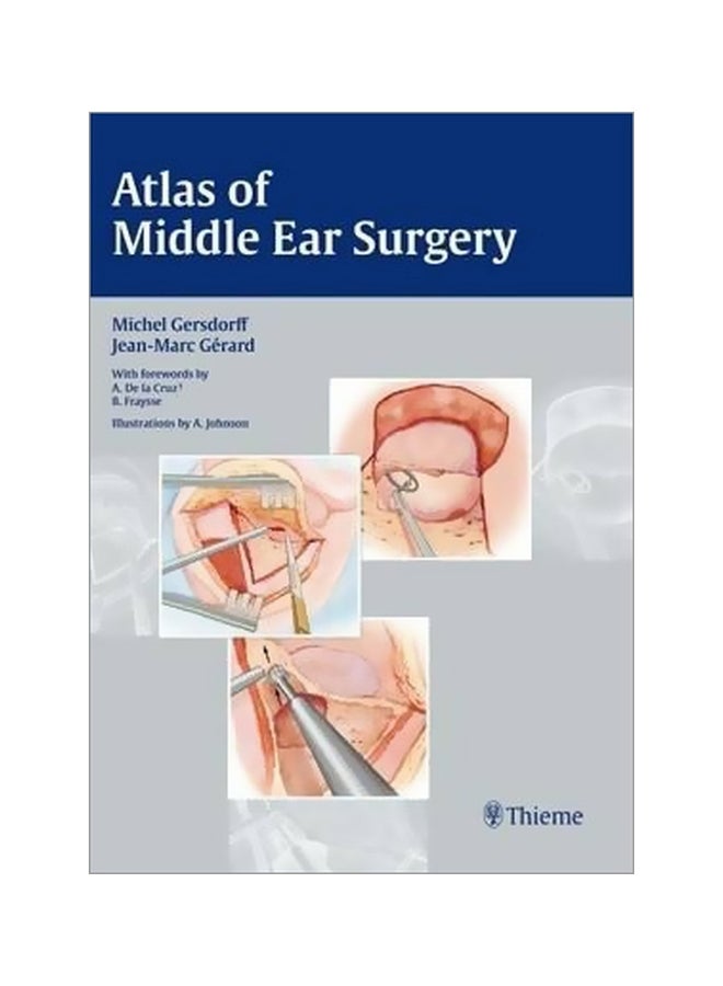Atlas Of Middle Ear Surgery Hardcover English by Michel Gersdorff - 10-Nov-10 