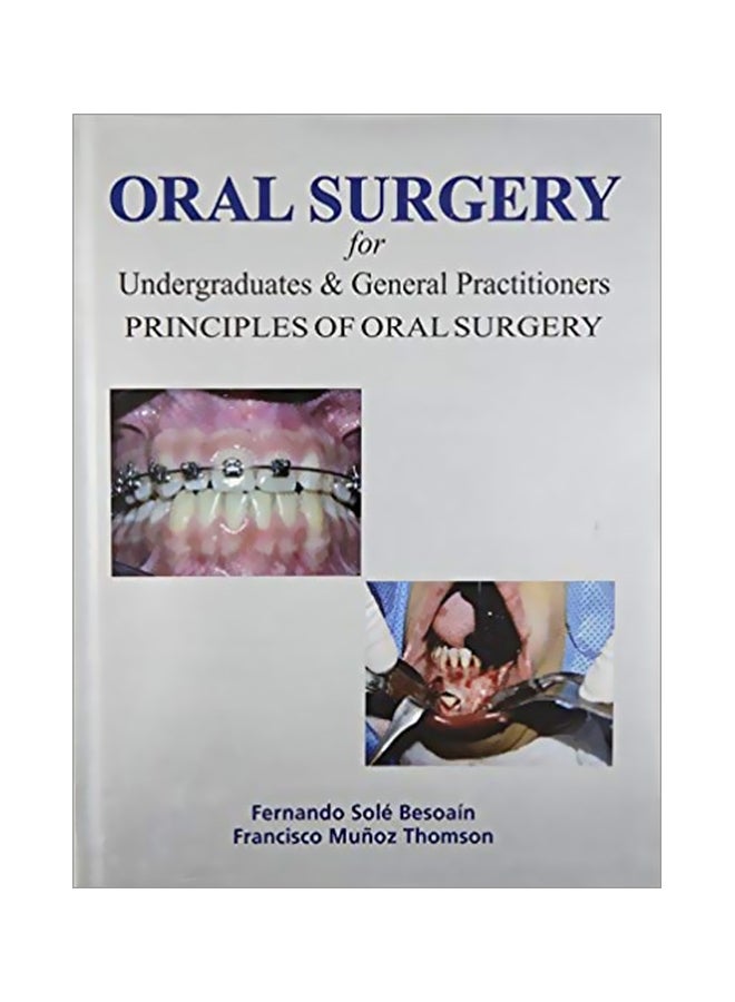 Oral Surgery For Undergraduates And General Practitioners Prin Paperback English by Fernando Sole Besoain - 4-March 2013