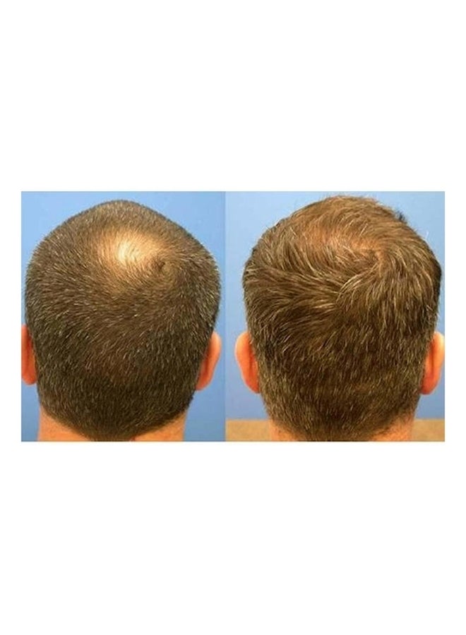 Power Grow - Comb Laser Hair Growth Stimulation For Men And Women - Image 1