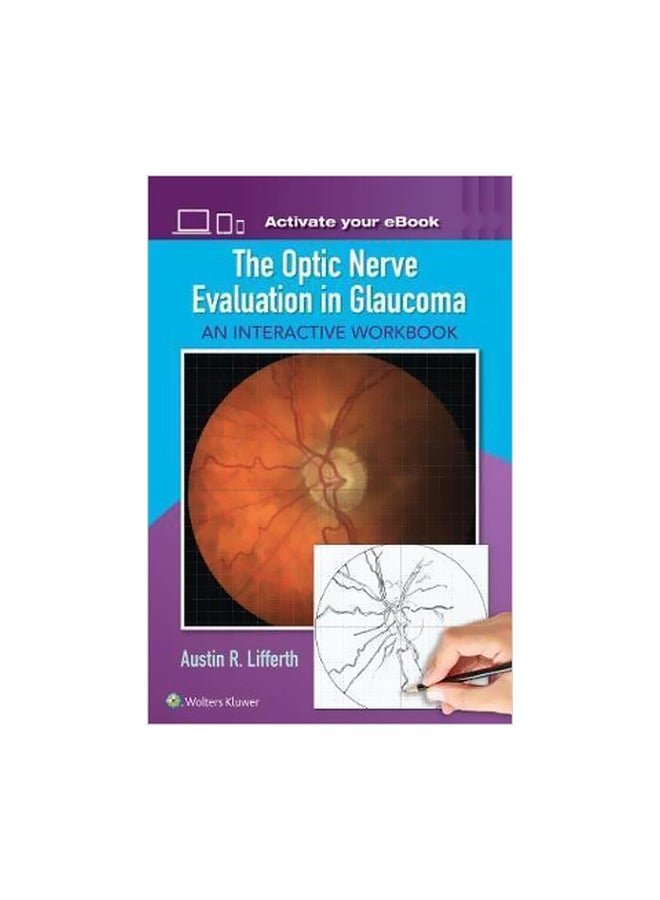 The Optic Nerve Evaluation in Glaucoma : An Interactive Workbook Paperback English by Austin Lifferth - 01 Jun 2017 