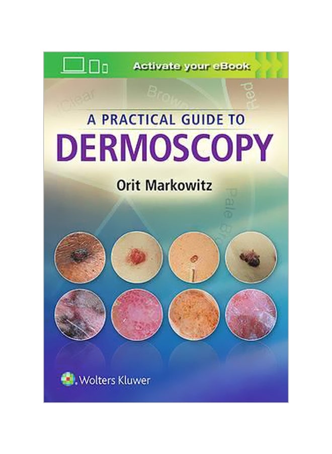 A Practical Guide To Dermoscopy Hardcover English by Orit Markowitz - 2 August 2017 