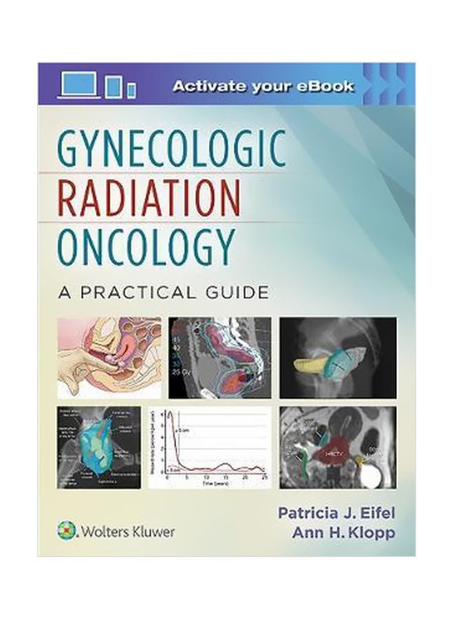 Gynecologic Radiation Oncology: A Practical Guide Hardcover English by Patricia J. Eifel - 25 September 2016 
