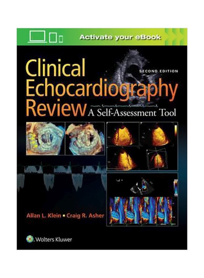 Clinical Echocardiography Review: A Self Assessment Tool Paperback English by Allan L. Klein - 26 April 2017