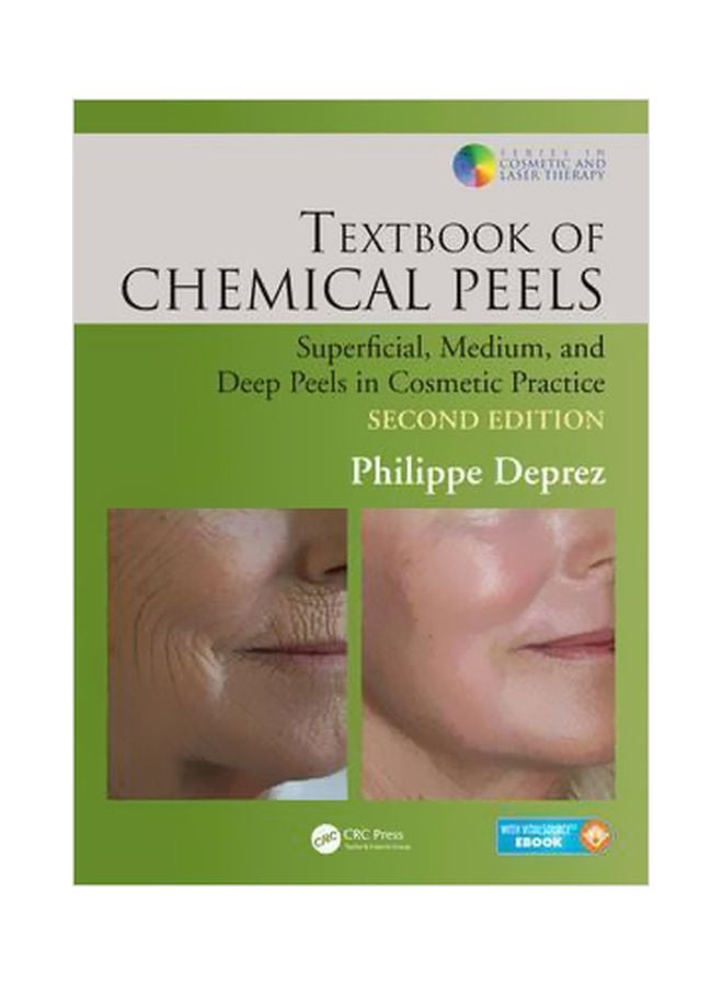 Textbook Of Chemical Peels: Superficial, Medium, And Deep Peels In Cosmetic Practice Hardcover English by Philippe Deprez - 27 July 2016 