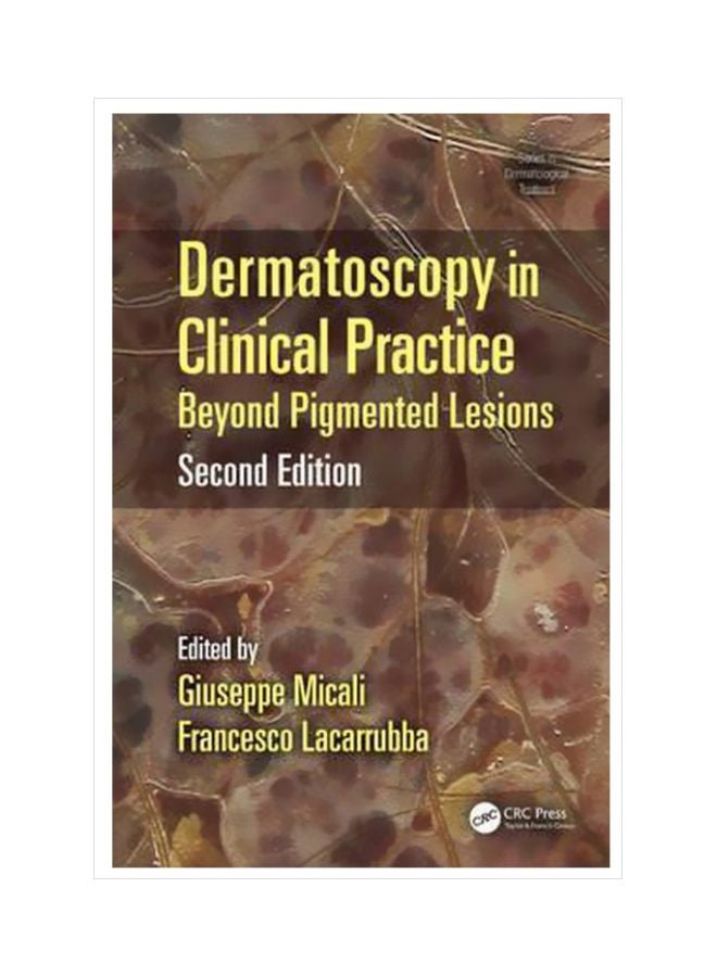 Dermatoscopy In Clinical Practice : Beyond Pigmented Lesions Hardcover English by Giuseppe Micali - 30 May 2016 