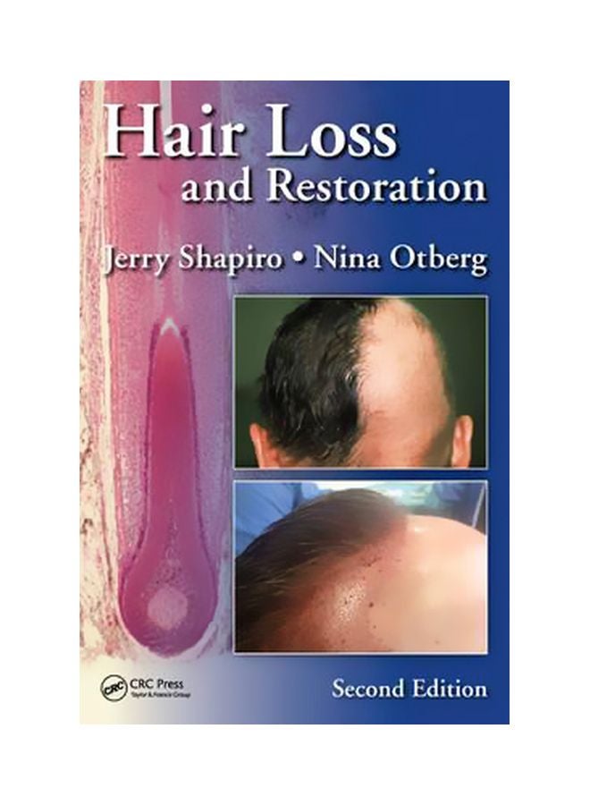 Hair Loss And Restoration Hardcover English by Jerry Shapiro - 5 June 2015 