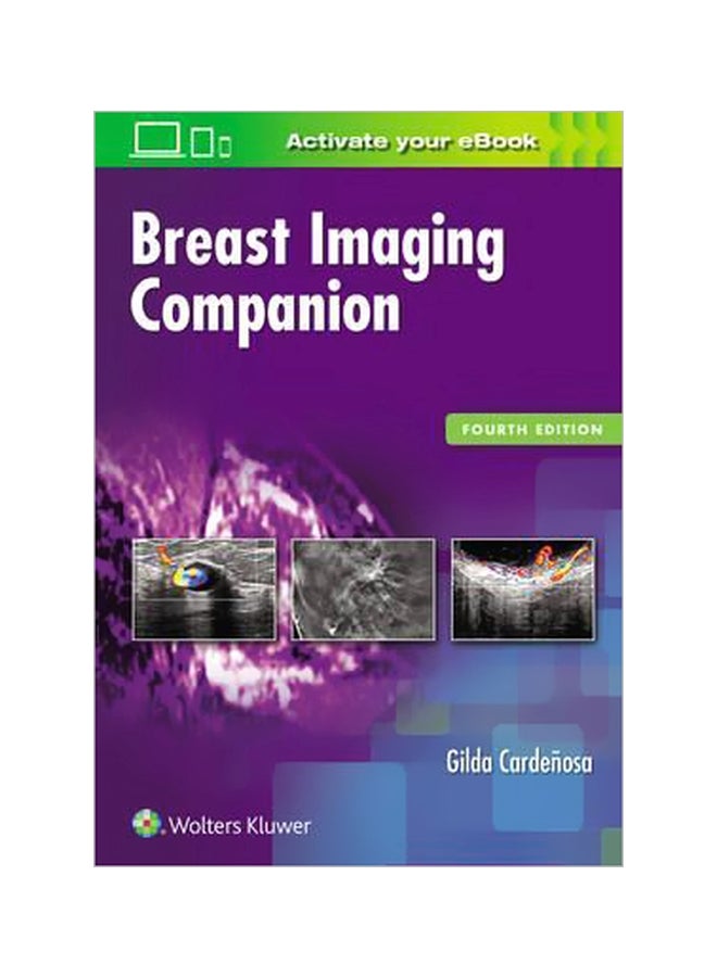 Breast Imaging Companion Paperback English by Gilda Cardenosa - 7 February 2017 