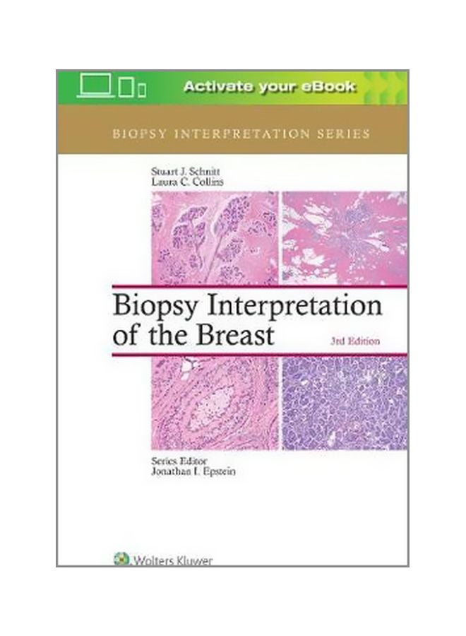 تفسير خزعة الثدي