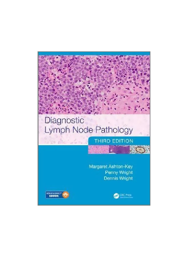 Diagnostic Lymph Node Pathology Hardcover English by Margaret Ashton-Key - 1 December 2017 
