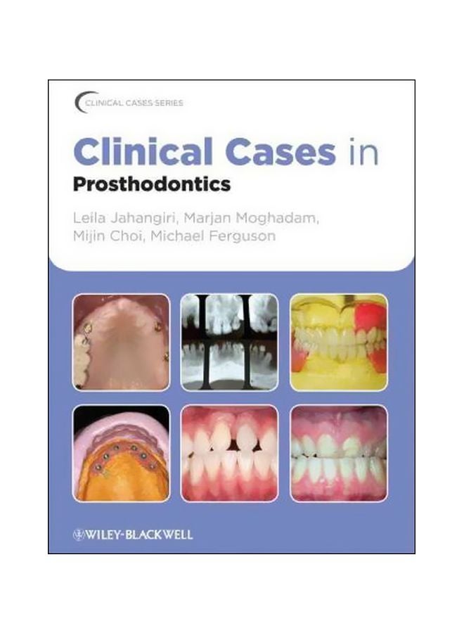 Clinical Cases In Prosthodontics Paperback English by Leila Jahangiri - 26 October 2010