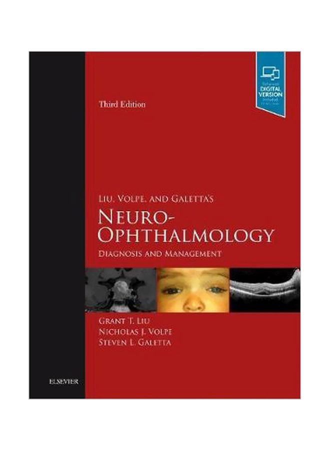 Neuro-ophthalmology : Diagnosis And Management Hardcover English by Grant T. Liu - 15 May 2018 