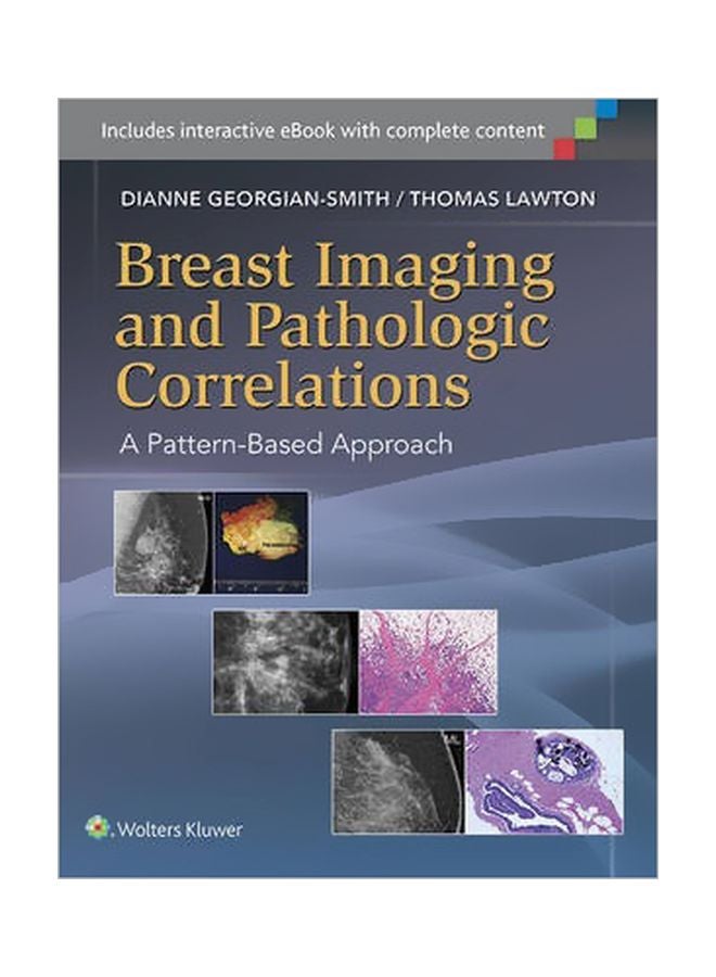 Breast Imaging And Pathologic Correlations: A Pattern-Based Approach Hardcover English by Dianne Georgian-smith - 10 December 2014 