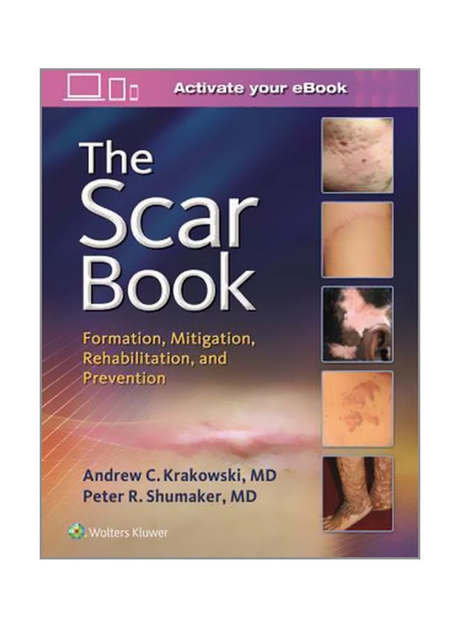The Scar Book: Formation, Mitigation, Rehabilitation And Prevention Hardcover English by Dr. Andrew C. Krakowski - 1 May 2017 