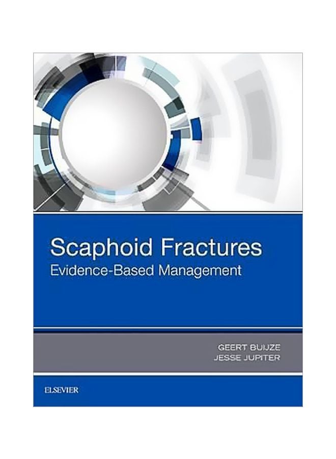 Scaphoid Fractures : Evidence-Based Management Hardcover English by Geert Buijze - 31 January 2018 