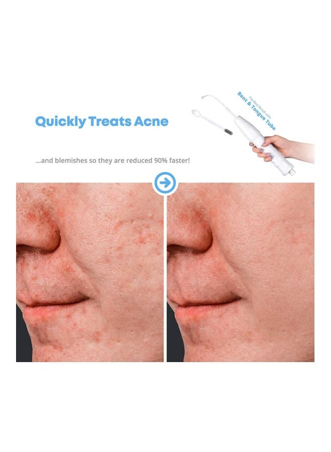 بلولانز جهاز عالي التردد لعلاج حب الشباب بتصميم قلم أبيض/فضي - Image 4