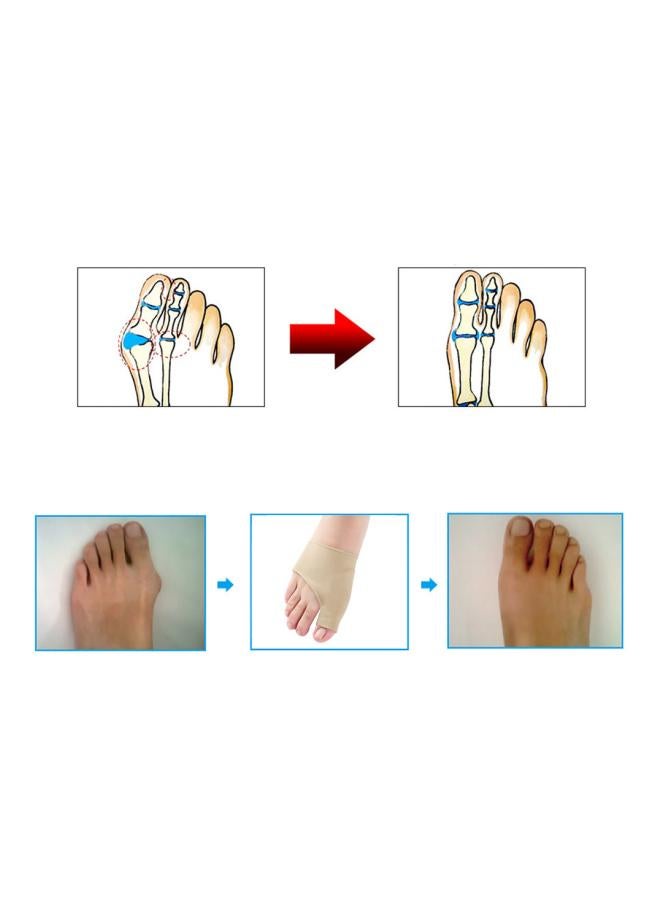 Generic Toe Corrector Pad Sleeve  - Image 4