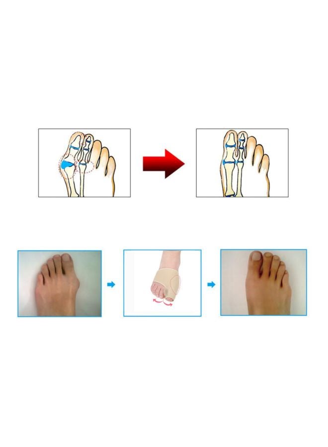 Generic Pair Of Hallux Relief Toe Corrector Pad Sleeves  - Image 3