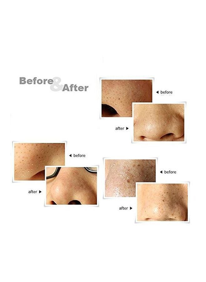 3-Piece Blackhead Remover Needle Silver - Image 3