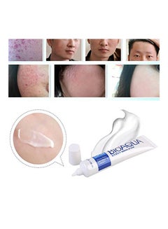 BIOAQUA Bioaqua Skin Removal Of Acne 30grams  - Image 4