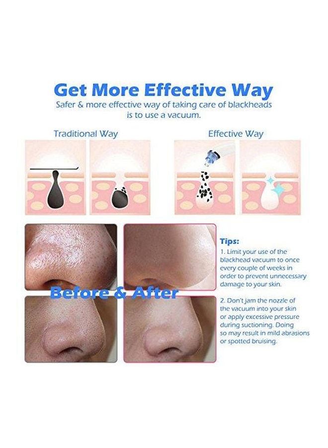 YupFun Blackhead Removing Vacuum Cleaner Brown - Image 3