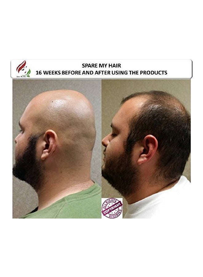 Spare My Hair - Softgel Vitamins For Thinning Hair - 90 Pills - Image 1