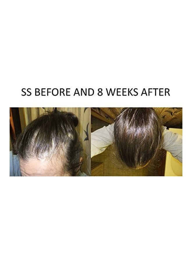 Spare My Hair - Softgel Vitamins For Thinning Hair - 90 Pills - Image 1