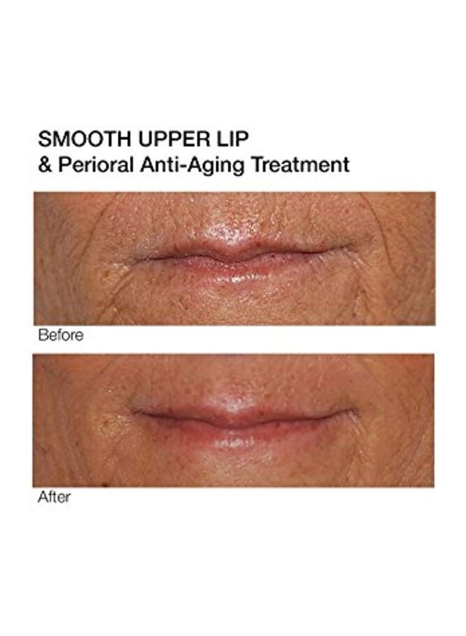 Dermelect Upper Lip And Perioral Anti-Aging Treatment - Image 5
