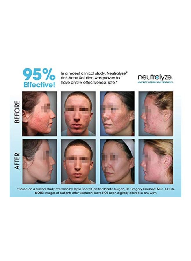 Neutralyze 100-Piece Exfoliating Pad  - Image 4