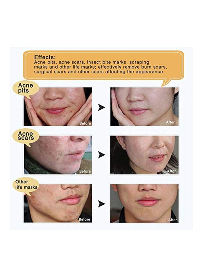 ALIVER - TCM Scar and Acne Mark Removal Gel Ointment 30grams - Image 1