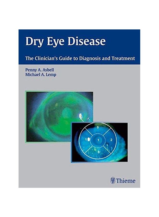 Dry Eye Disease: The Clinician's Guide To Diagnosis And Treatment hardcover english - 01-Nov-06 