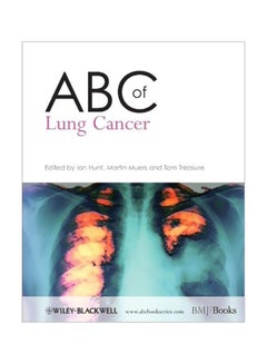 ABC Of Lung Cancer paperback english - 01-May-09 