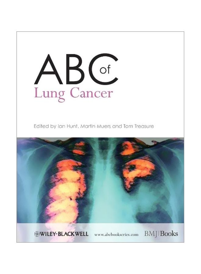 ABC Of Lung Cancer paperback english - 01-May-09
