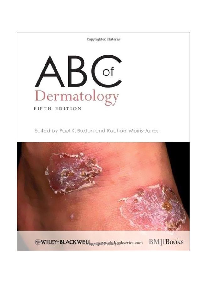 ABC Of Dermatology Paperback English - 01-Apr-14 