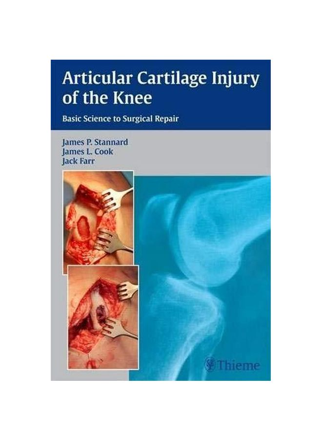 Articular Cartilage Injury Of The Knee: Basic Science To Surgical Repair hardcover english - 08-May-13 