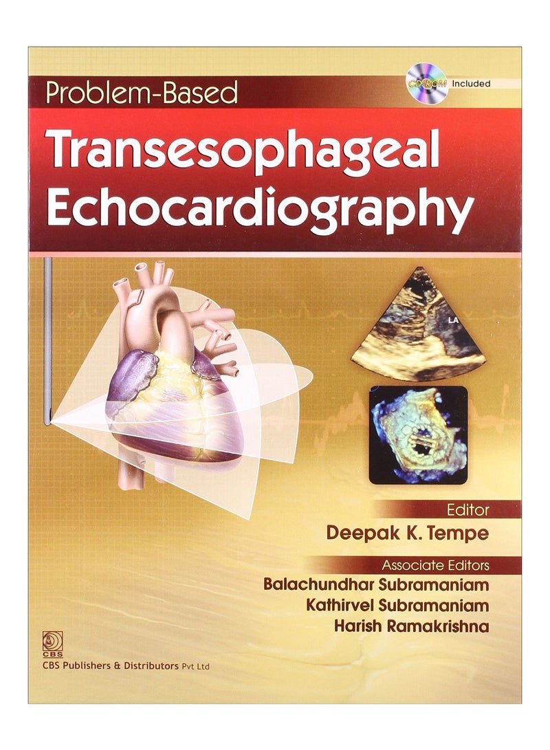Problem - Based Transesophageal Echocardiography Hardcover English by Tempe - 16-Oct-14 